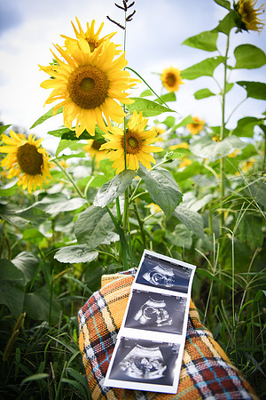 Baby H 171